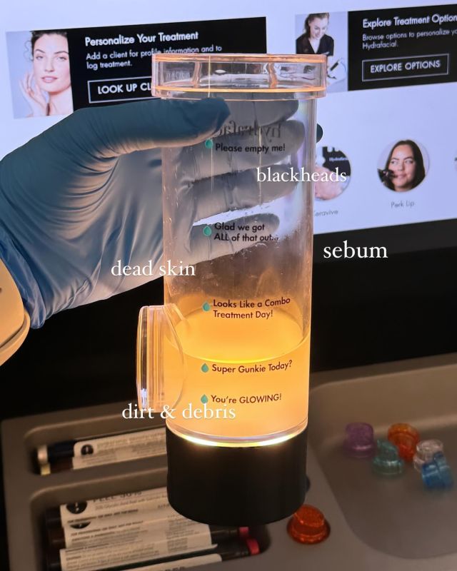 👀 Here is a look at the #gunkie jar that is filled with all the gunk that is extracted during your HydraFacial treatment. 
 
A HydraFacial is a non-invasive, restorative treatment. It uses patented technology to cleanse, extract, and hydrate the skin. It uses hydradermabrasion to evenly exfoliate and extract impurities and dead skin cells. At the same time, it replenishes vital nutrients including antioxidants, peptides, and hyaluronic acid.

Ready to experience the HydraFacial glow? 💧💫
Call today to book yours! 
+ Chico, Yuba City & Oroville 

#gunkie #hydrafacial #esthetician #glow