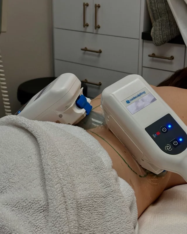Say goodbye to stubborn fat! No surgery, no downtime. 
CoolSculpting targets and freezes away fat cells for a slimmer, more sculpted you❄️

Call us to schedule a complimentary consultation and see if this treatment is right for you!